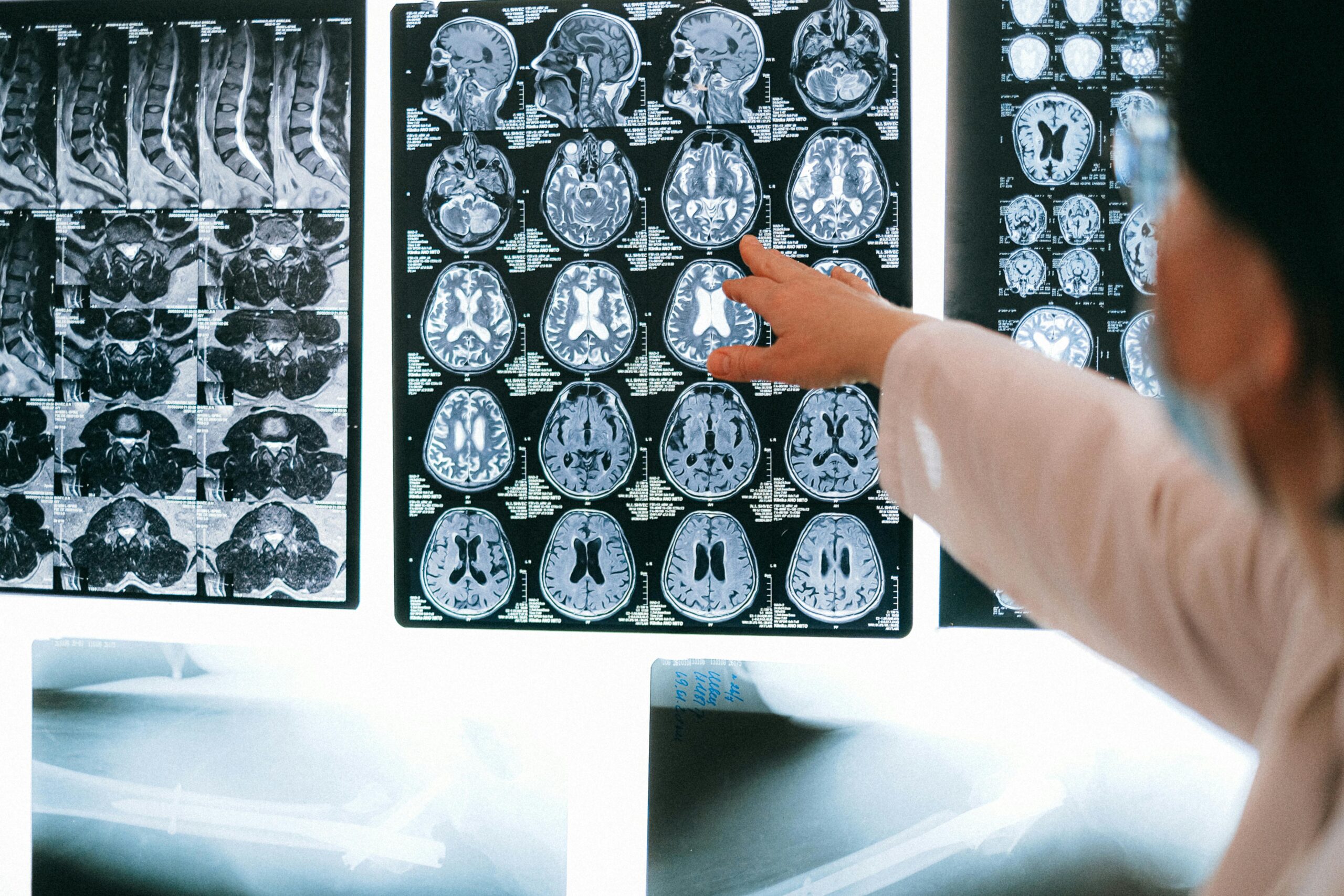 Radiologist pointing at brain MRI scans showing detailed medical examination.