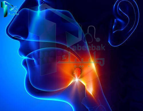 سرطان الحنجرة المبكر