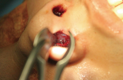 منظار الأنف للاطفال